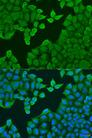 ARF3 Antibody - Immunofluorescence analysis of U2OS cells using ARF3 Polyclonal Antibody at dilution of 1:100.Blue: DAPI for nuclear staining.