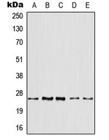 ARF4 Antibody - Western blot analysis of ARF4 expression in HeLa (A); HepG2 (B); mouse liver (C); mouse kidney (D); rat kidney (E) whole cell lysates.