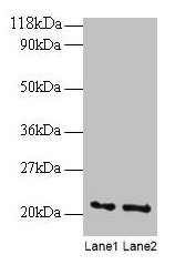 ARF4 Antibody - Western blot All lanes: ADP-ribosylation factor 4 antibody at 2µg/ml Lane 1: EC109 whole cell lysate Lane 2: 293T whole cell lysate Secondary Goat polyclonal to rabbit IgG at 1/15000 dilution Predicted band size: 20 kDa Observed band size: 20 kDa