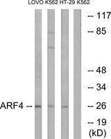 ARF4 Antibody - Western blot analysis of extracts from LOVO cells, K562 cells and HT-29 cells, using ARF4 antibody.