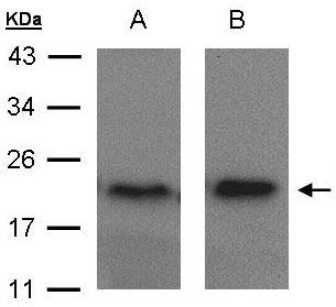 ARF5 Antibody - Sample (30 ug of whole cell lysate). A: MOLT4, B: Raji. 15% SDS PAGE. ARF5 antibody diluted at 1:1500