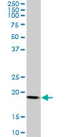 ARF5 Antibody - ARF5 monoclonal antibody (M01), clone 1B4. Western Blot analysis of ARF5 expression in HeLa.