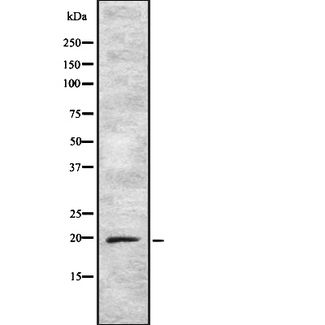ARF5 Antibody - Western blot analysis of ARF5 using K562 whole cells lysates