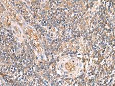 ARF5 Antibody - Immunohistochemistry of paraffin-embedded Human tonsil tissue  using ARF5 Polyclonal Antibody at dilution of 1:40(×200)
