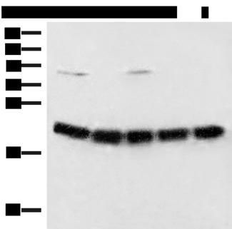 ARF5 Antibody - Western blot analysis of Raji cell Mouse brain tissue Hela A375 and 231 cell lysates  using ARF5 Polyclonal Antibody at dilution of 1:400