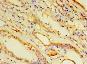 ARF6 Antibody - Immunohistochemistry of paraffin-embedded human kidney using antibody at 1:100 dilution.  This image was taken for the unconjugated form of this product. Other forms have not been tested.