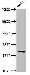 ARF6 Antibody - Western Blot Positive WB detected in: Hela whole cell lysate All lanes: ARF6 antibody at 4.8µg/ml Secondary Goat polyclonal to rabbit IgG at 1/50000 dilution Predicted band size: 21 kDa Observed band size: 21 kDa