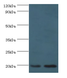 ARF6 Antibody - Western blot. All lanes: ARF6 antibody at 2 ug/ml. Lane 1: 293T whole cell lysate. Lane 2: HepG2 whole cell lysate. Secondary antibody: Goat polyclonal to rabbit at 1:10000 dilution. Predicted band size: 20 kDa. Observed band size: 20 kDa.