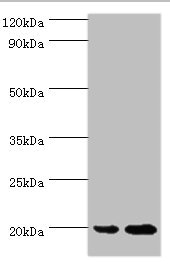 ARF6 Antibody - Western blot All lanes: ARF6 antibody at 2µg/ml Lane 1: 293T whole cell lysate Lane 2: HepG2 whole cell lysate Secondary Goat polyclonal to rabbit IgG at 1/10000 dilution Predicted band size: 20 kDa Observed band size: 20 kDa