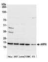 ARF6 Antibody - Detection of human and mouse ARF6 by western blot. Samples: Whole cell lysate (50 µg) from HeLa, HEK293T, Jurkat, mouse TCMK-1, and mouse NIH 3T3 cells prepared using NETN lysis buffer. Antibody: Affinity purified rabbit anti-ARF6 antibody used for WB at 0.1 µg/ml. Detection: Chemiluminescence with an exposure time of 30 seconds.