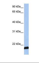 ARF6 Antibody - MCF7 cell lysate. Antibody concentration: 1.0 ug/ml. Gel concentration: 12%.  This image was taken for the unconjugated form of this product. Other forms have not been tested.