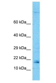 ARF6 Antibody - ARF6 antibody Western Blot of MCF7. Antibody dilution: 1 ug/ml.  This image was taken for the unconjugated form of this product. Other forms have not been tested.