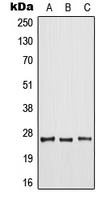 ARF6 Antibody - Western blot analysis of ARF6 expression in HeLa (A); mouse liver (B); rat spleen (C) whole cell lysates.
