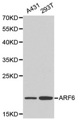 ARF6 Antibody - Western blot of ARF6 pAb in extracts from A431 and 293T cells.