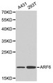 ARF6 Antibody - Western blot of ARF6 pAb in extracts from A431 and 293T cells.