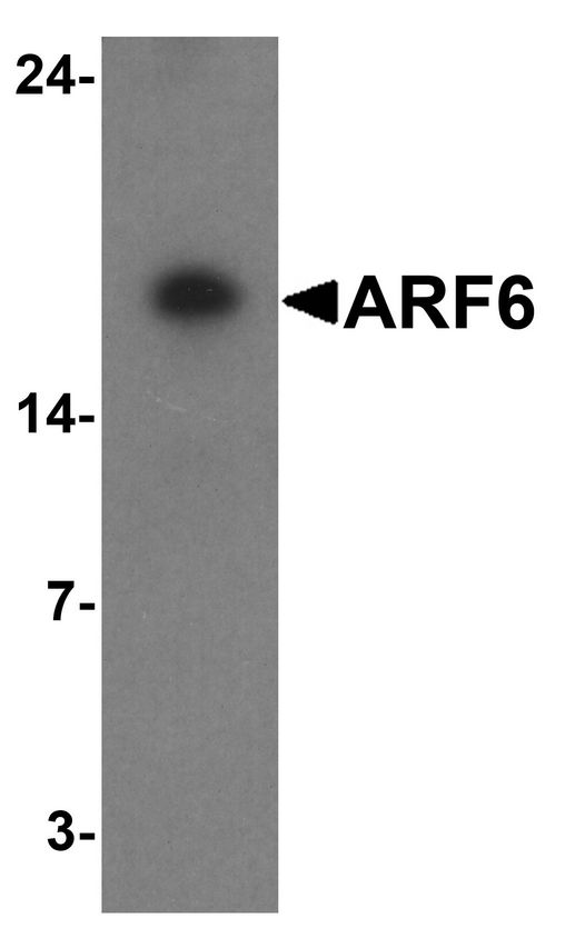 ARF6 Antibody - Western blot analysis of ARF6 in rat liver tissue lysate with ARF6 antibody at 1 ug/ml.