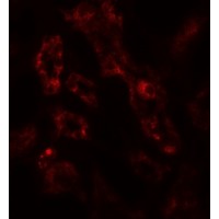 ARF6 Antibody - Immunofluorescence of ARF6 in human kidney tissue with ARF6 antibody at 20 µg/mL.
