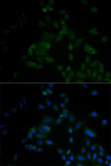 ARF6 Antibody - Immunofluorescence analysis of A549 cell using ARF6 antibody. Blue: DAPI for nuclear staining.