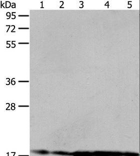 ARF6 Antibody - Western blot analysis of HeLa and 293T cell, mouse liver tissue, A431 and MCF-7 cell, using ARF6 Polyclonal Antibody at dilution of 1:450.