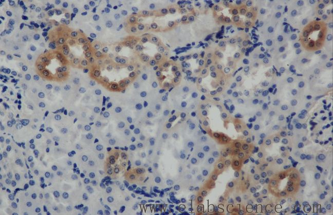 ARF6 Antibody - Immunohistochemistry of paraffin-embedded mouse kidney using ARF6 Polyclonal Antibody at dilution of 1:50.