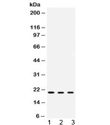 ARF6 Antibody - Western blot testing of 1) rat kidney, 2) mouse kidney and 3) human MCF7 lysate with ARF6 antibody at 0.5ug/ml. Predicted molecular weight ~20 kDa.