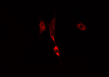 ARF6 Antibody - Staining COLO205 cells by IF/ICC. The samples were fixed with PFA and permeabilized in 0.1% Triton X-100, then blocked in 10% serum for 45 min at 25°C. The primary antibody was diluted at 1:200 and incubated with the sample for 1 hour at 37°C. An Alexa Fluor 594 conjugated goat anti-rabbit IgG (H+L) antibody, diluted at 1/600, was used as secondary antibody.
