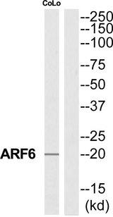 ARF6 Antibody - Western blot analysis of extracts from COLO205 cells, using ARF6 antibody.