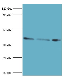 ARFGAP1 Antibody - Western blot. All lanes: ADP-ribosylation factor GTPase-activating protein 1 antibody at 8 ug/ml. Lane 1: PC-3 whole cell lysate. Lane 2: HeLa whole cell lysate. Lane 3: mouse brain tissue. secondary Goat polyclonal to rabbit at 1:10000 dilution. Predicted band size: 45 kDa. Observed band size: 45 kDa.