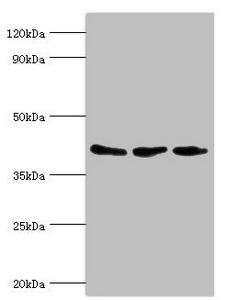 ARFGAP1 Antibody - Western blot All lanes: ADP-ribosylation factor GTPase-activating protein 1 antibody at 8µg/ml Lane 1: PC-3 whole cell lysate Lane 2: Hela whole cell lysate Lane 3: Mouse brain tissue Secondary Goat polyclonal to rabbit IgG at 1/10000 dilution Predicted band size: 45, 46, 32, 40 kDa Observed band size: 45 kDa