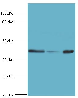 ARFGAP1 Antibody - Western blot. All lanes: ADP-ribosylation factor GTPase-activating protein 1 antibody at 5 ug/ml. Lane 1: PC-3 whole cell lysate. Lane 2: HeLa whole cell lysate. Lane 3: mouse brain tissue. secondary Goat polyclonal to rabbit at 1:10000 dilution. Predicted band size: 45 kDa. Observed band size: 45 kDa.