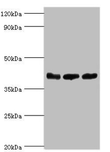 ARFGAP1 Antibody - Western blot All lanes: ADP-ribosylation factor GTPase-activating protein 1 antibody at 5µg/ml Lane 1: PC-3 whole cell lysate Lane 2: Hela whole cell lysate Lane 3: Mouse brain tissue Secondary Goat polyclonal to rabbit IgG at 1/10000 dilution Predicted band size: 45, 46, 32, 40 kDa Observed band size: 45 kDa