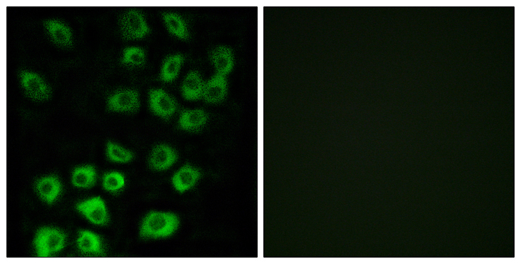 ARFGAP1 Antibody - Immunofluorescence analysis of MCF7 cells, using ARFGAP1 Antibody. The picture on the right is blocked with the synthesized peptide.