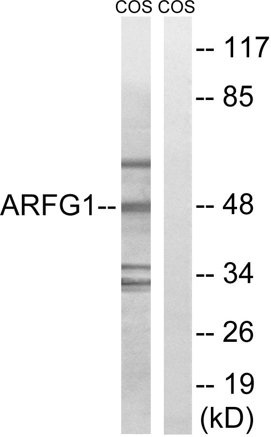 ARFGAP1 Antibody - Western blot analysis of lysates from COS7 cells, using ARFGAP1 Antibody. The lane on the right is blocked with the synthesized peptide.