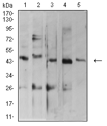 ARFGAP1 Antibody - Western blot analysis using ARFGAP1 mouse mAb against MOLT4 (1), C2C12 (2), HepG2 (3), MCF-7 (4), and Lncap (5) cell lysate.