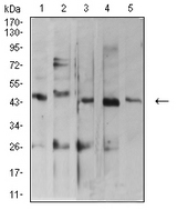ARFGAP1 Antibody - Western blot analysis using ARFGAP1 mouse mAb against MOLT4 (1), C2C12 (2), HepG2 (3), MCF-7 (4), and Lncap (5) cell lysate.