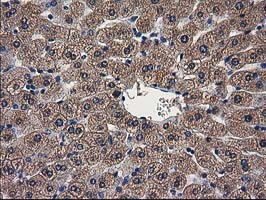 ARFGAP1 Antibody - IHC of paraffin-embedded Human liver tissue using anti-ARFGAP1 mouse monoclonal antibody.