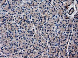 ARFGAP1 Antibody - IHC of paraffin-embedded Human pancreas tissue using anti-ARFGAP1 mouse monoclonal antibody.