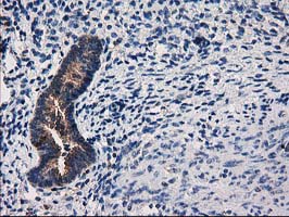 ARFGAP1 Antibody - IHC of paraffin-embedded Human endometrium tissue using anti-ARFGAP1 mouse monoclonal antibody.