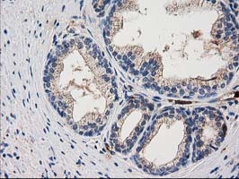 ARFGAP1 Antibody - IHC of paraffin-embedded Human prostate tissue using anti-ARFGAP1 mouse monoclonal antibody.