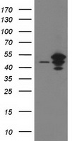 ARFGAP1 Antibody - HEK293T cells were transfected with the pCMV6-ENTRY control (Left lane) or pCMV6-ENTRY ARFGAP1 (Right lane) cDNA for 48 hrs and lysed. Equivalent amounts of cell lysates (5 ug per lane) were separated by SDS-PAGE and immunoblotted with anti-ARFGAP1.
