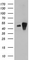 ARFGAP1 Antibody - HEK293T cells were transfected with the pCMV6-ENTRY control (Left lane) or pCMV6-ENTRY ARFGAP1 (Right lane) cDNA for 48 hrs and lysed. Equivalent amounts of cell lysates (5 ug per lane) were separated by SDS-PAGE and immunoblotted with anti-ARFGAP1.