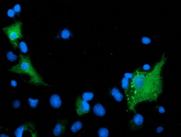 ARFGAP1 Antibody - Anti-ARFGAP1 mouse monoclonal antibody immunofluorescent staining of COS7 cells transiently transfected by pCMV6-ENTRY ARFGAP1.