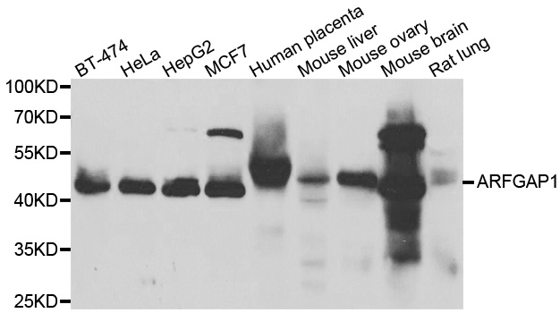 ARFGAP1 Antibody - Western blot analysis of extracts of various cell lines.