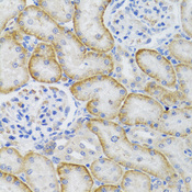 ARFGAP1 Antibody - Immunohistochemistry of paraffin-embedded rat kidney tissue.