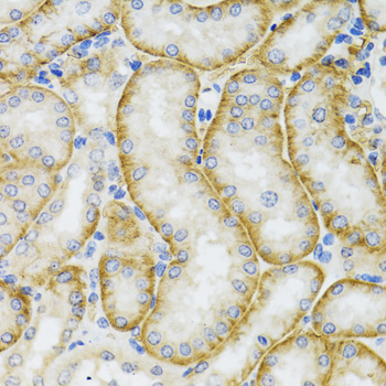 ARFGAP1 Antibody - Immunohistochemistry of paraffin-embedded mouse kidney tissue.