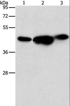 ARFGAP1 Antibody - Western blot analysis of 293T, PC3 and NIH/3T3 cell, using ARFGAP1 Polyclonal Antibody at dilution of 1:850.