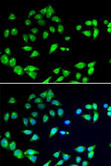 ARFGAP1 Antibody - Immunofluorescence analysis of A549 cells using ARFGAP1 antibody. Blue: DAPI for nuclear staining.