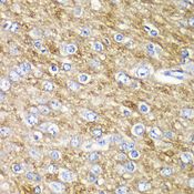 ARFGAP1 Antibody - Immunohistochemistry of paraffin-embedded rat brain using ARFGAP1 antibody at dilution of 1:100 (40x lens).