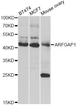 ARFGAP1 Antibody - Western blot analysis of extracts of various cell lines, using ARFGAP1 antibody at 1:1000 dilution. The secondary antibody used was an HRP Goat Anti-Rabbit IgG (H+L) at 1:10000 dilution. Lysates were loaded 25ug per lane and 3% nonfat dry milk in TBST was used for blocking. An ECL Kit was used for detection and the exposure time was 3s.