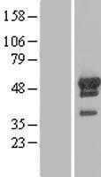 ARFGAP1 Protein - Western validation with an anti-DDK antibody * L: Control HEK293 lysate R: Over-expression lysate